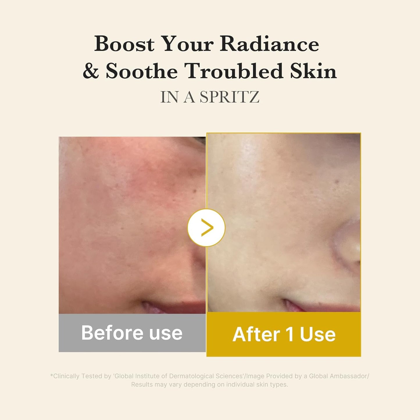 MEDICUBE Kojic Acid Turmeric Vita Jelly Serum Mist 100ml